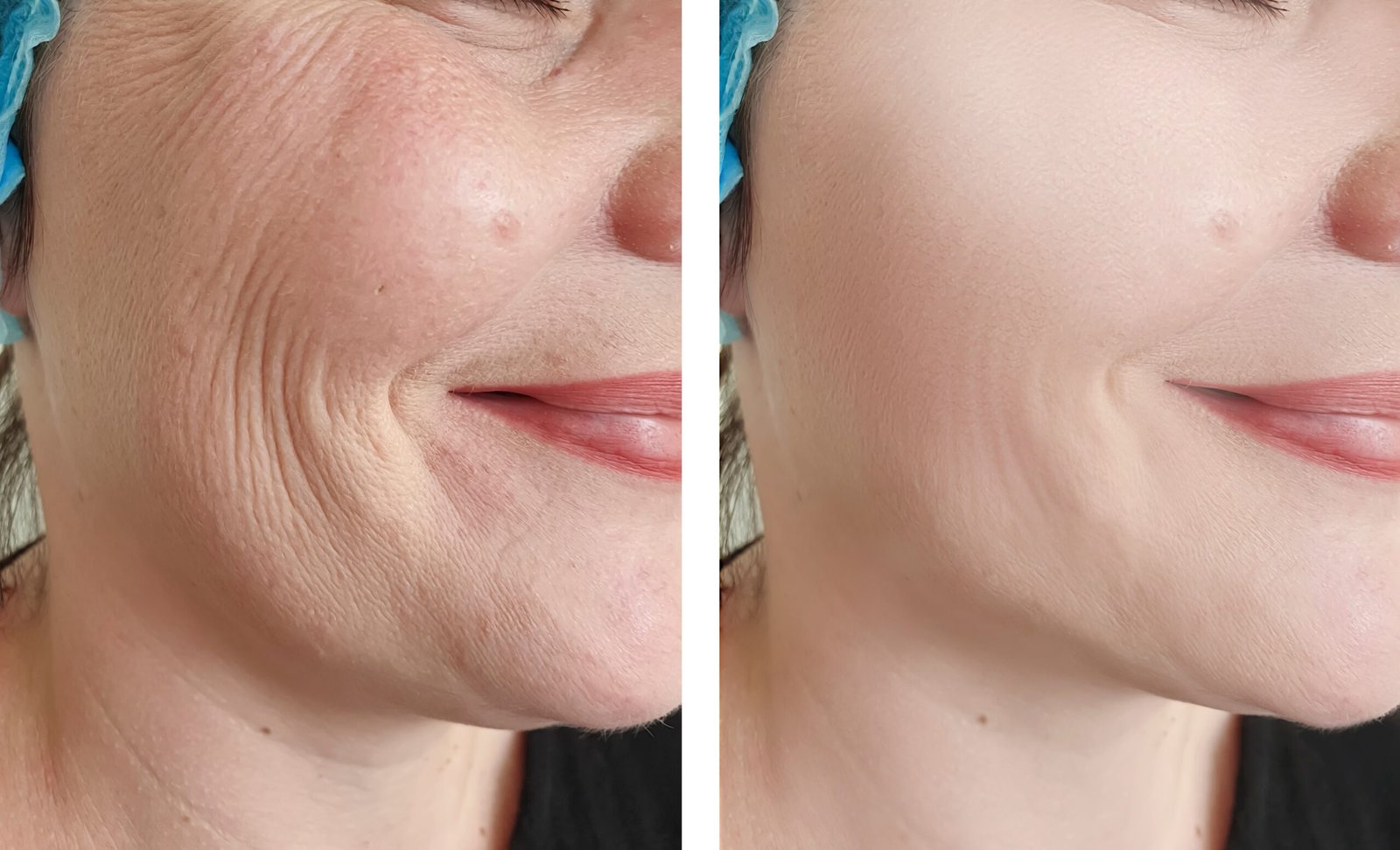 Estética Avançada Angra dos Reis – Dra. Amanda Silva (11)