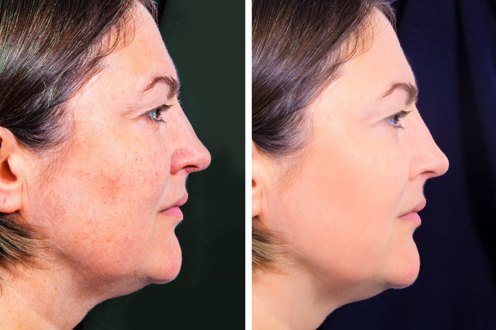 Estética Avançada Angra dos Reis – Dra. Amanda Silva (14)