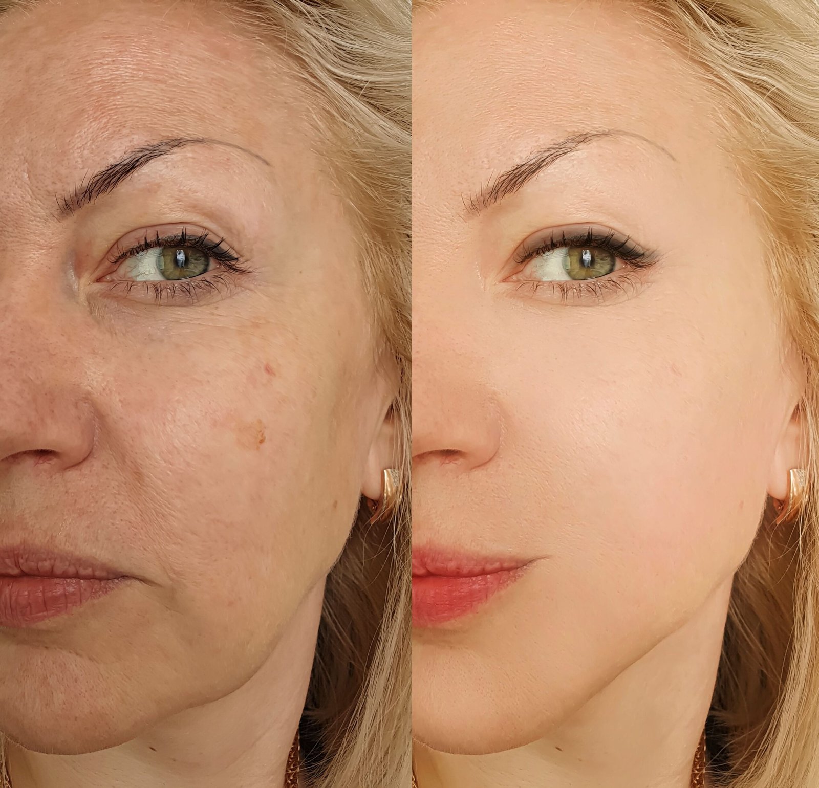 Estética Avançada Angra dos Reis – Dra. Amanda Silva (15)