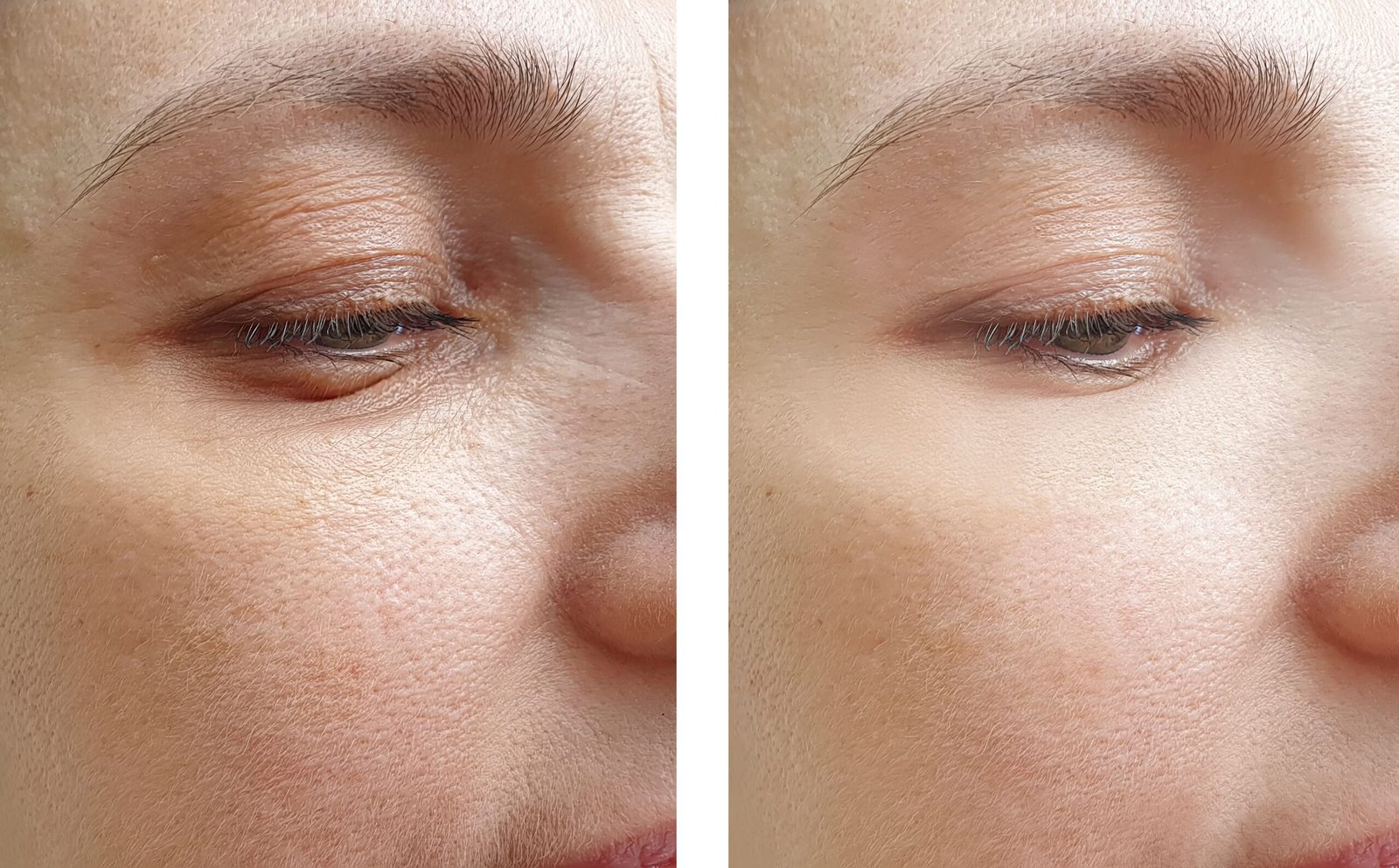 Estética Avançada Angra dos Reis – Dra. Amanda Silva (16)