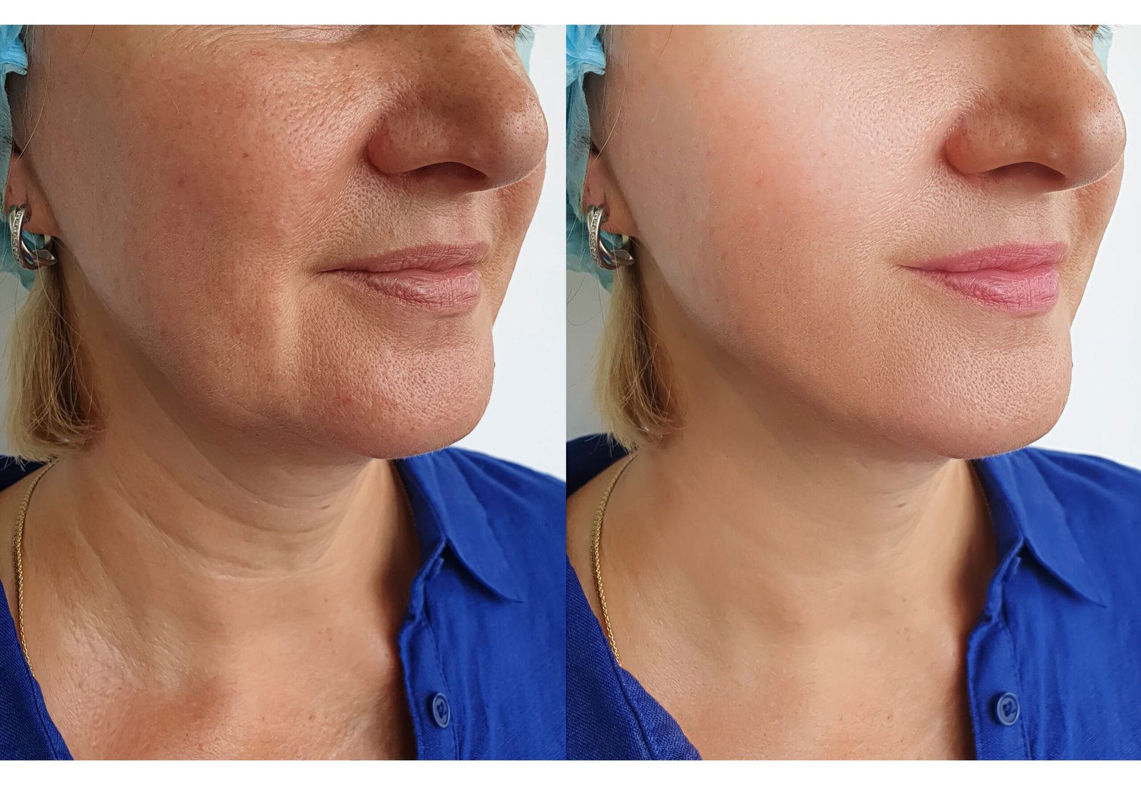 Estética Avançada Angra dos Reis – Dra. Amanda Silva (18)