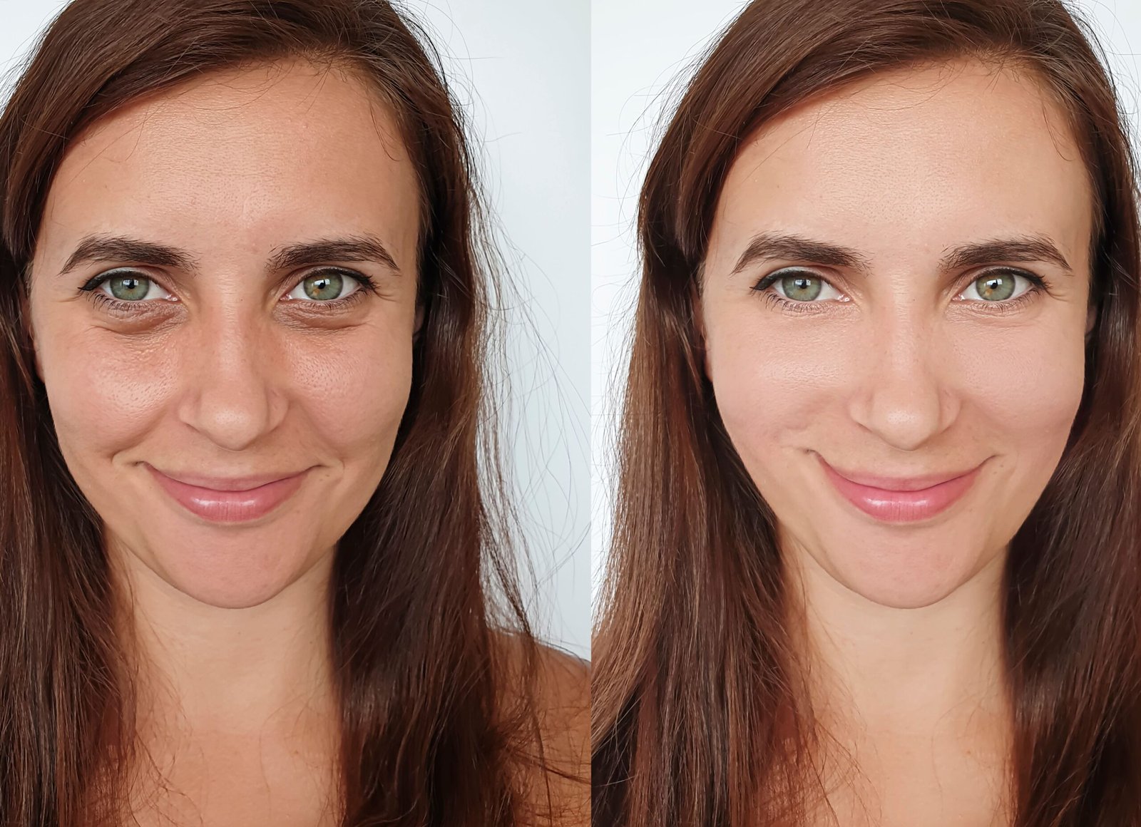 Estética Avançada Angra dos Reis – Dra. Amanda Silva (20)